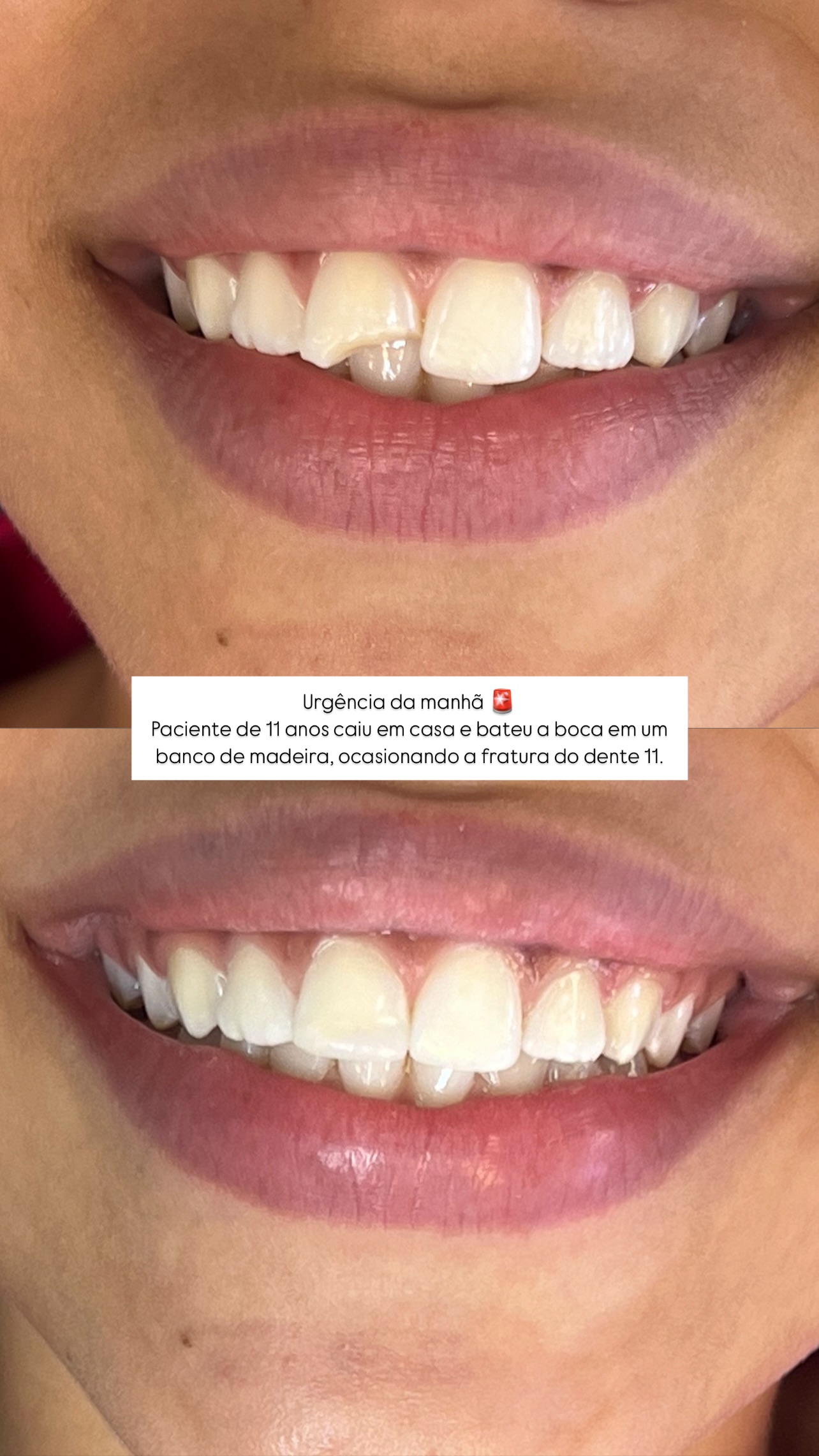 Exemplo de Resultado 1