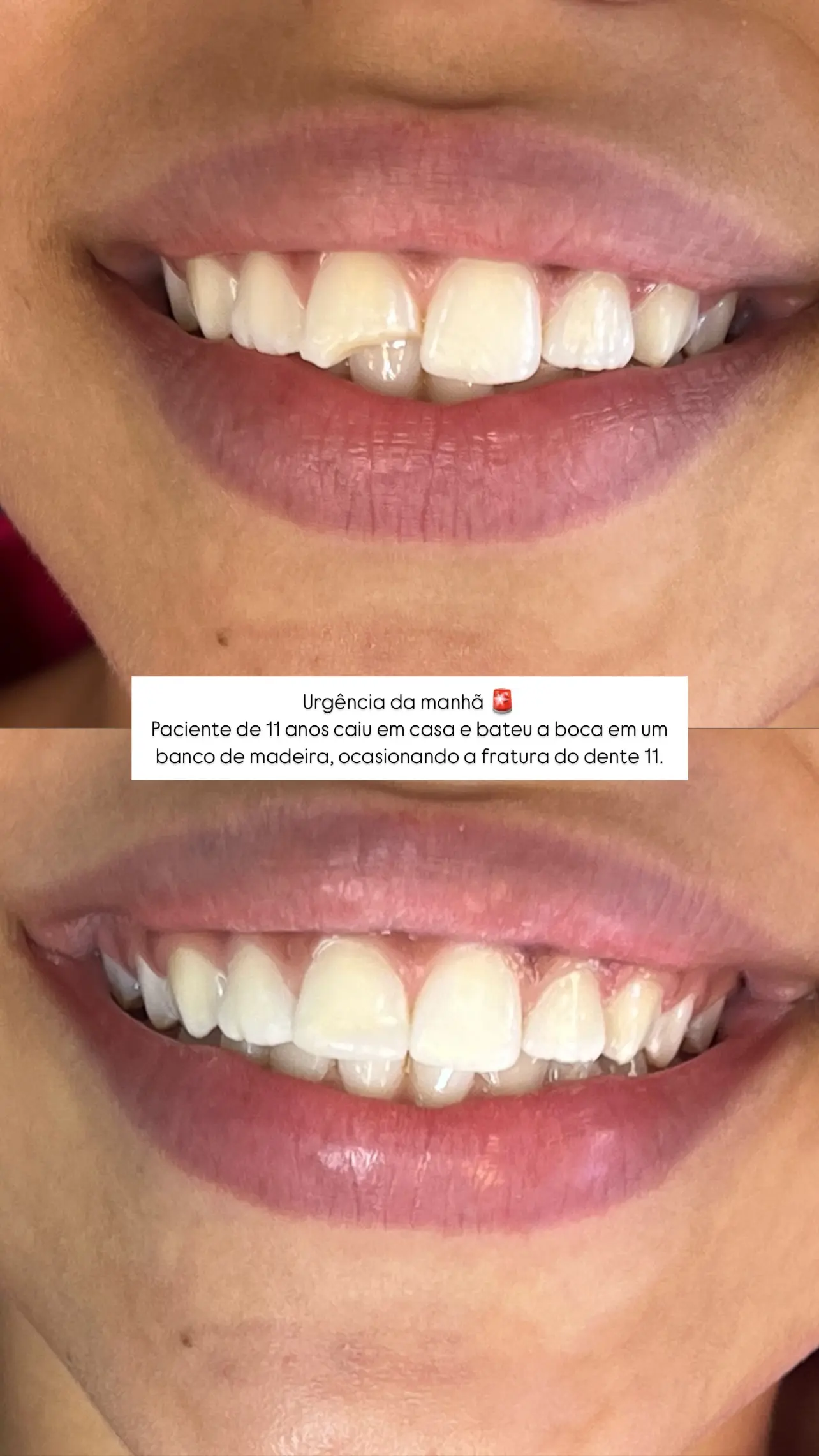 Exemplo de Resultado 1