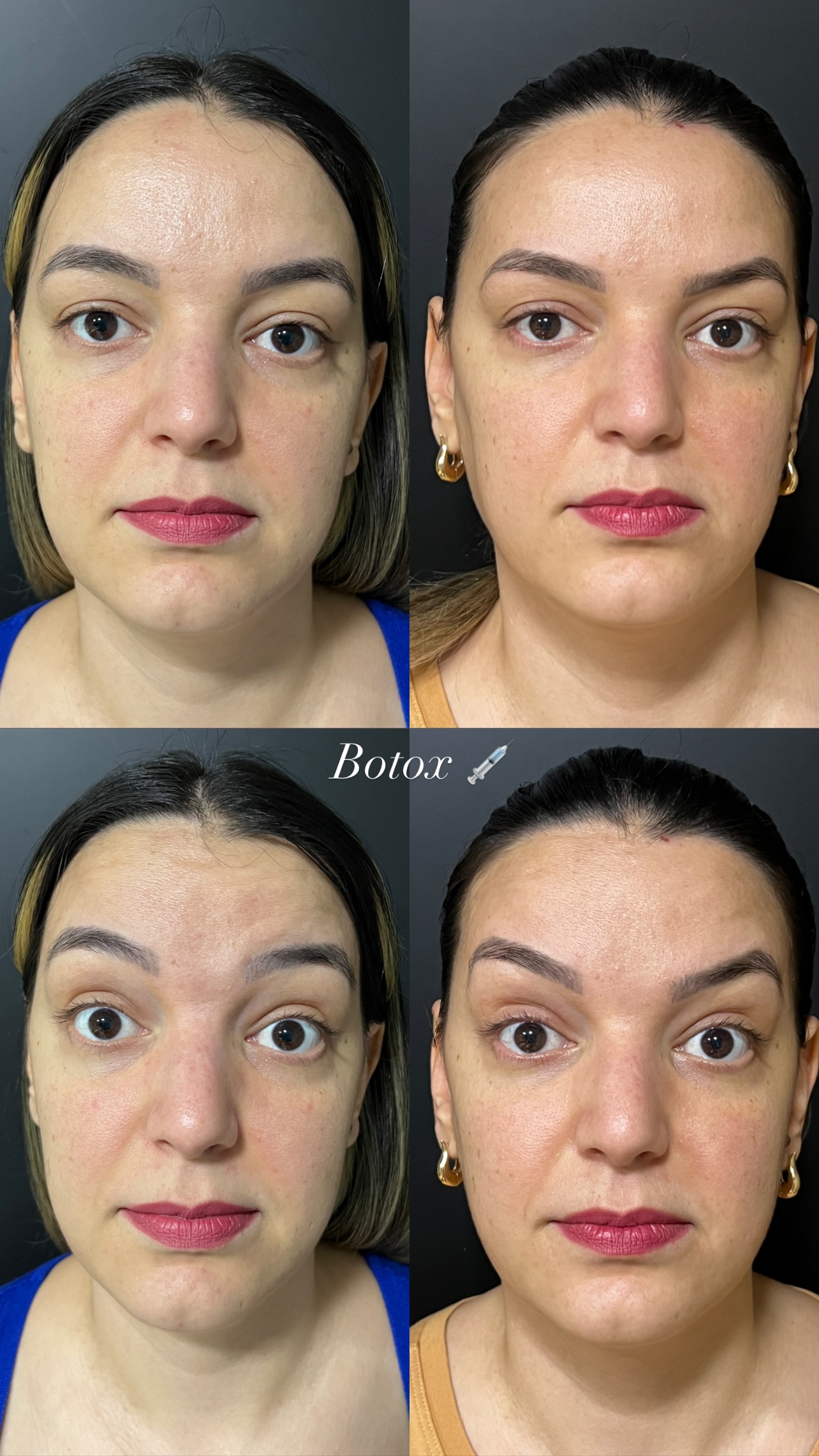 Exemplo de Resultado 2