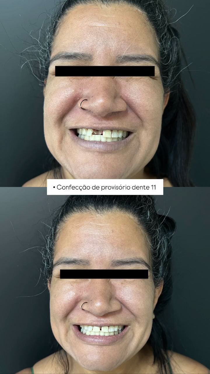 Exemplo de Resultado 3