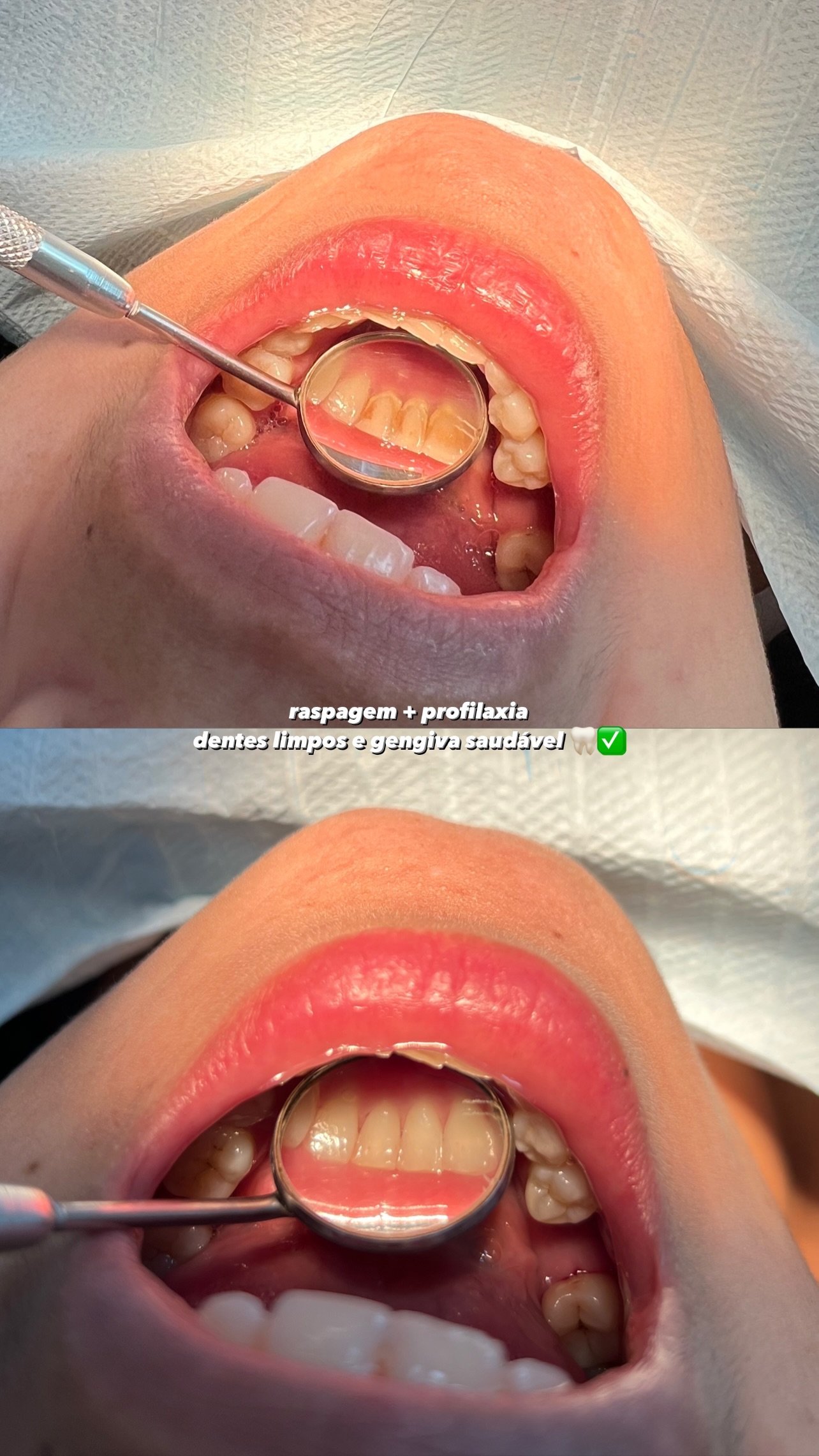 Exemplo de Resultado 4