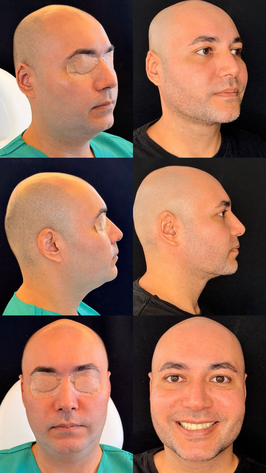 Exemplo de Resultado 6