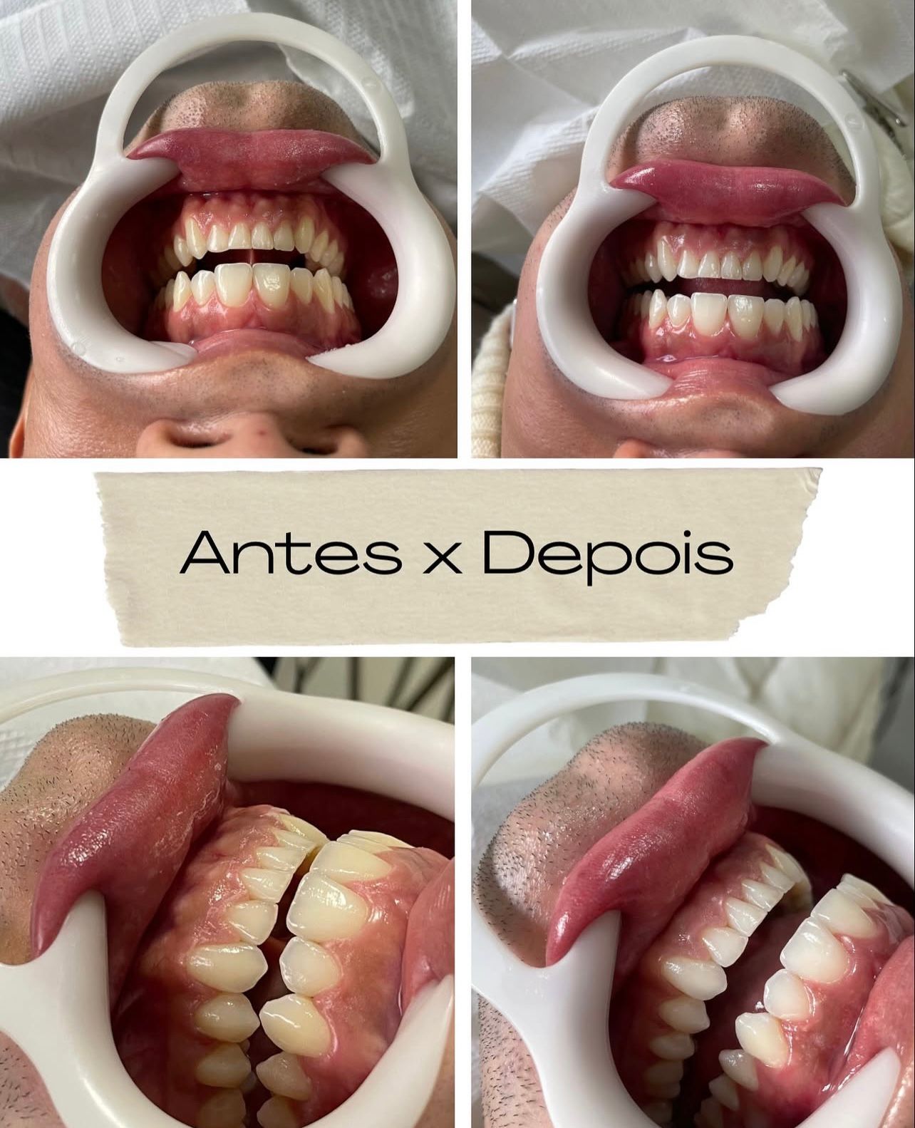 Exemplo de Resultado Inicial