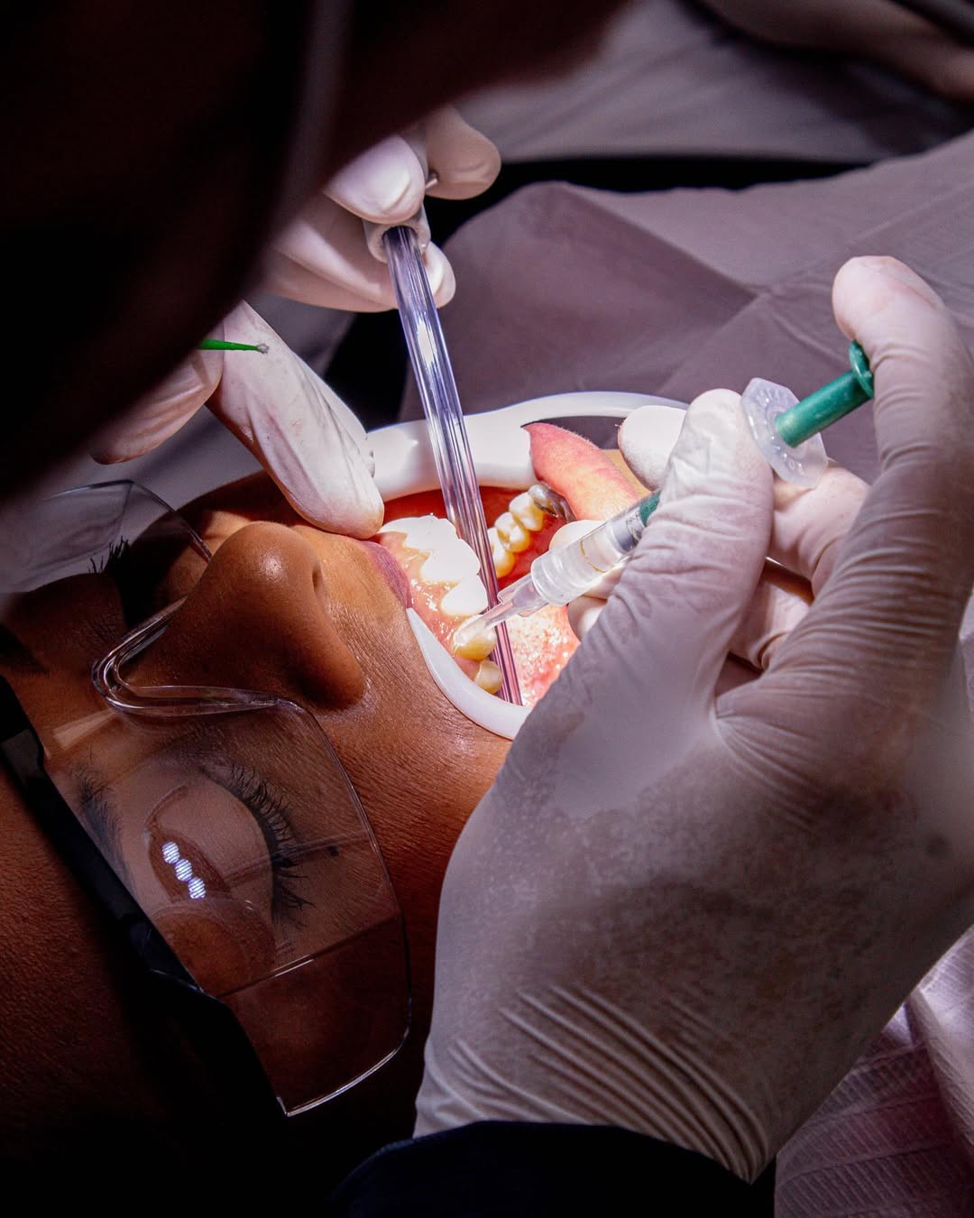 Tratamento com Precisão